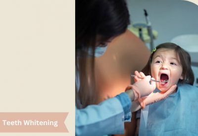 Teeth Whitening