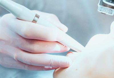 Root Canal Procedure